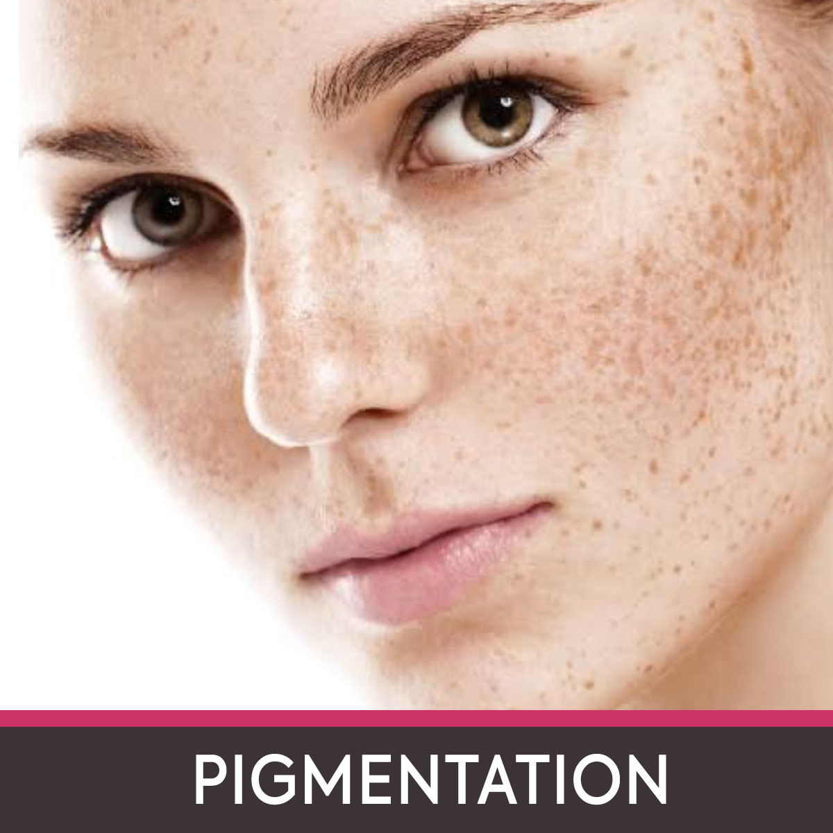  Pigmentation